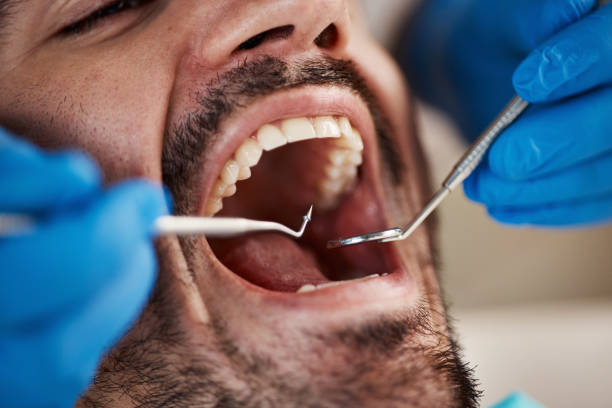 Best Urgent Dental Care for Toothache in Huntland, TN