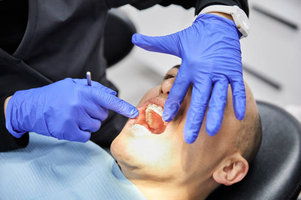 Best Emergency Dentist for Knocked-Out Tooth in Huntland, TN
