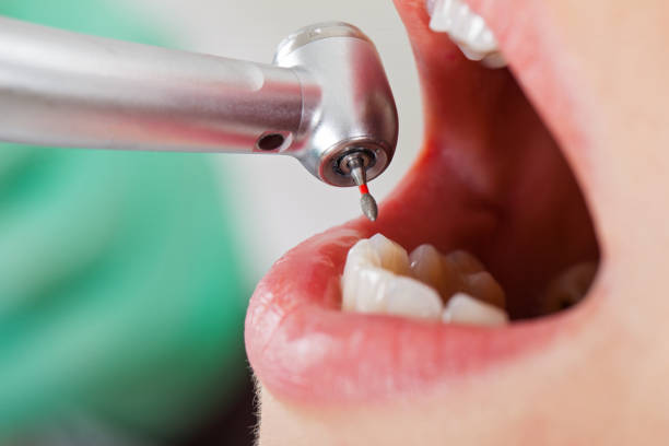 Best Broken or Cracked Tooth Emergency Dentist in Huntland, TN